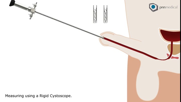 Уретральный стимулятор 