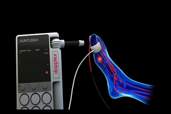 ポケットサイズ超音波ドップラー - Dopplex ATP - Huntleigh