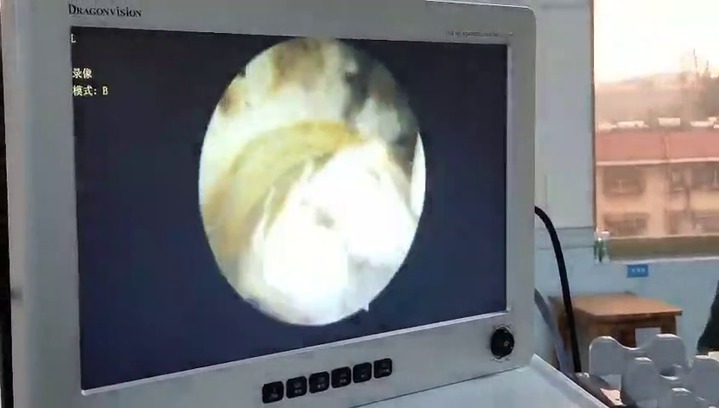 Endoscope camera - IO20260 - Guangdong Softlink Innovation Medical -  digital / full HD / CMOS